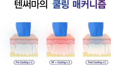 쿨링 매커니즘