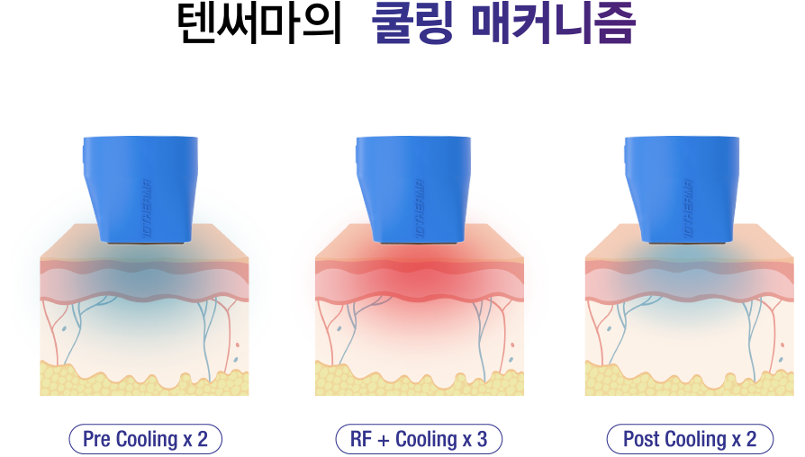 쿨링 매커니즘